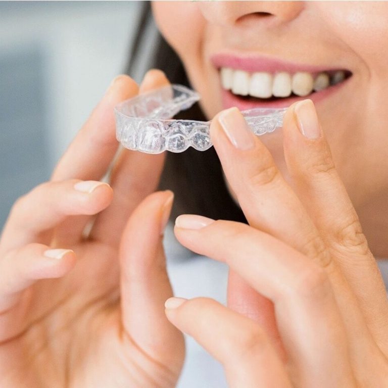 Invisalign feature Image