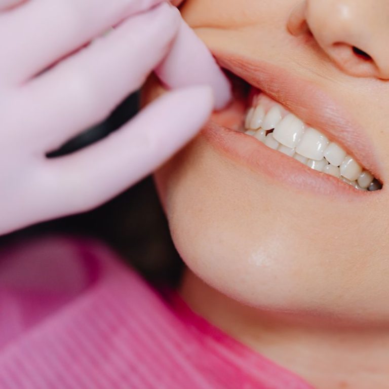 Oral Hygiene