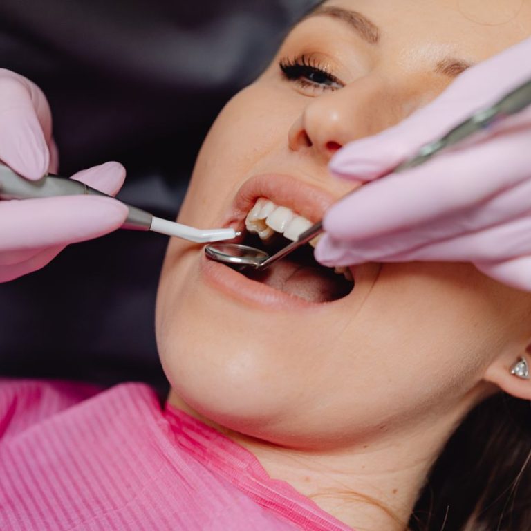 dental filling feature image